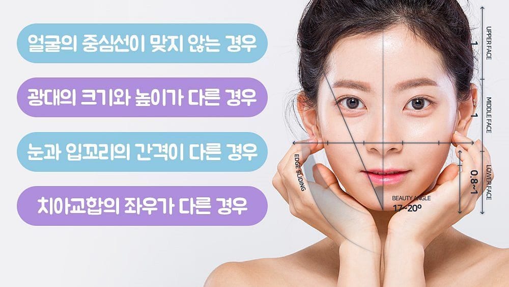 안면비대칭 자가진단 기준 — 얼굴 중심선, 광대 높이, 눈과 입꼬리 간격, 치아 교합의 좌우 차이
