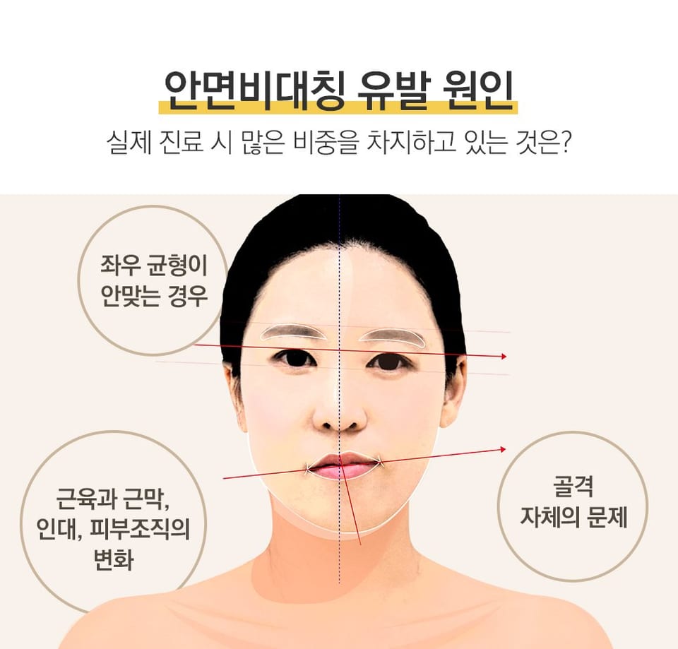 안면비대칭 유발 원인 — 좌우 균형이 안 맞는 경우, 근육·근막·인대·피부조직의 변화, 골격 자체의 문제